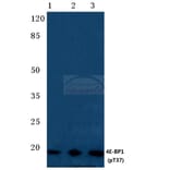 Anti-4E-BP1 (phospho-T37) Antibody from Bioworld Technology (BS4746) - Antibodies.com