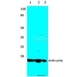 Anti-4E-BP1 (phospho-T46) Antibody from Bioworld Technology (BS4747) - Antibodies.com