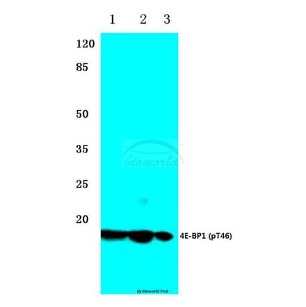 Anti-4E-BP1 (phospho-T46) Antibody from Bioworld Technology (BS4747) - Antibodies.com