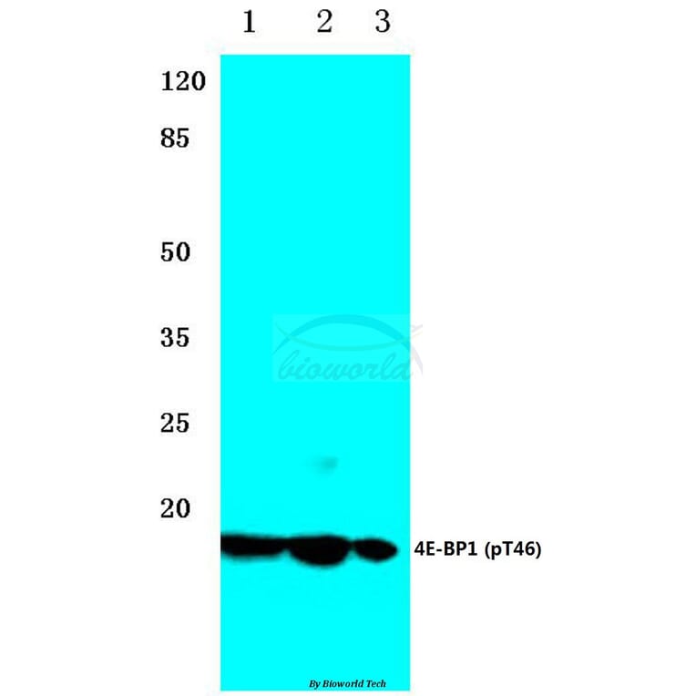 Anti-4E-BP1 (phospho-T46) Antibody from Bioworld Technology (BS4747) - Antibodies.com