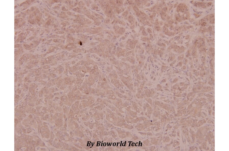 Anti-4E-BP1 (phospho-T46) Antibody from Bioworld Technology (BS4747) - Antibodies.com