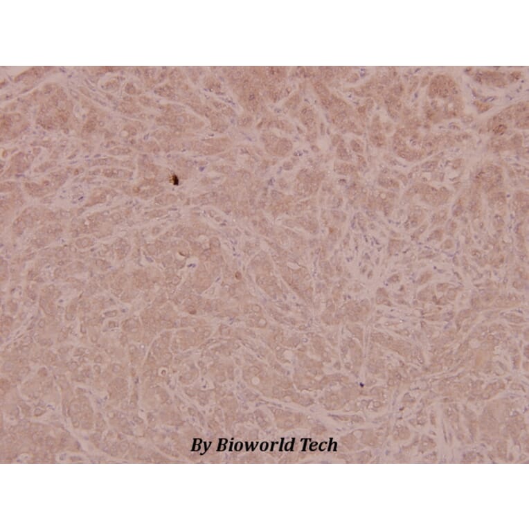 Anti-4E-BP1 (phospho-T46) Antibody from Bioworld Technology (BS4747) - Antibodies.com