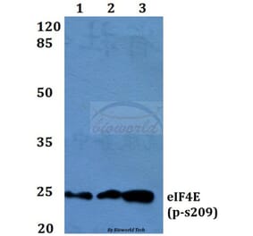 Anti-eIF4E (phospho-S209) Antibody from Bioworld Technology (BS4748) - Antibodies.com