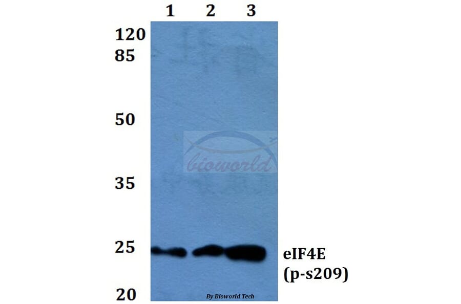 Anti-eIF4E (phospho-S209) Antibody from Bioworld Technology (BS4748) - Antibodies.com