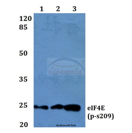 Anti-eIF4E (phospho-S209) Antibody from Bioworld Technology (BS4748) - Antibodies.com