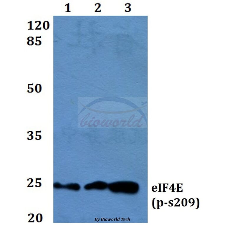 Anti-eIF4E (phospho-S209) Antibody from Bioworld Technology (BS4748) - Antibodies.com