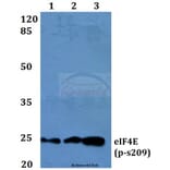 Anti-eIF4E (phospho-S209) Antibody from Bioworld Technology (BS4748) - Antibodies.com