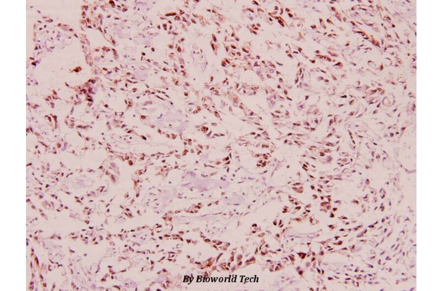 Anti-BRCA1 (phospho-S1423) Antibody from Bioworld Technology (BS4756) - Antibodies.com