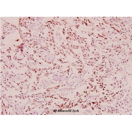 Anti-BRCA1 (phospho-S1423) Antibody from Bioworld Technology (BS4756) - Antibodies.com