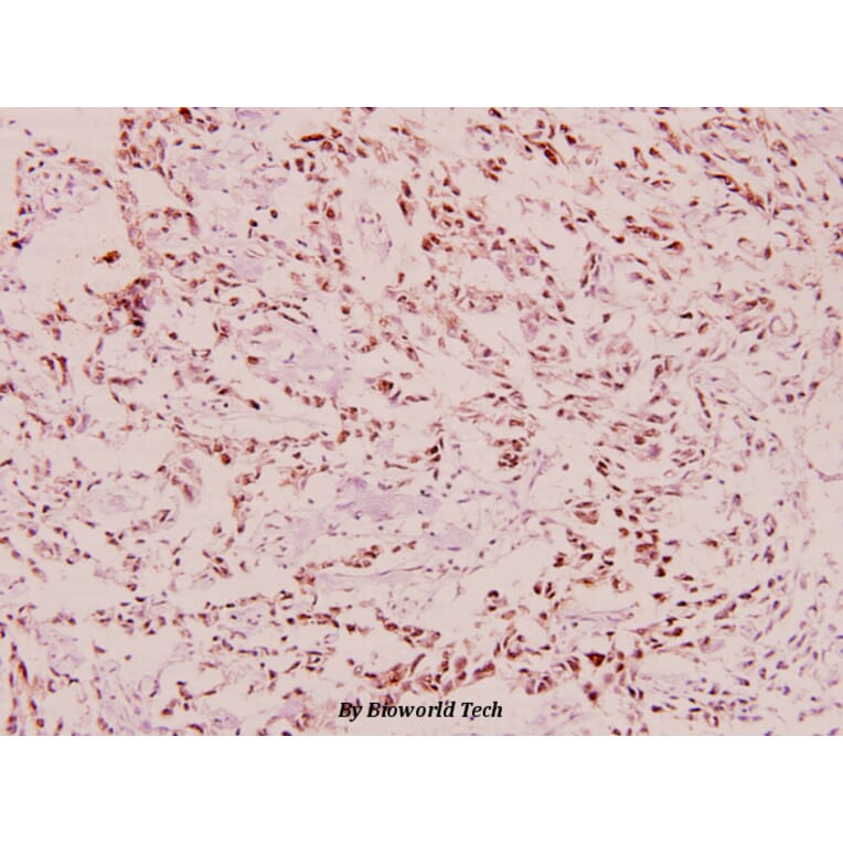 Anti-BRCA1 (phospho-S1423) Antibody from Bioworld Technology (BS4756) - Antibodies.com