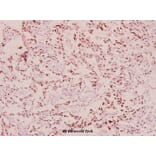 Anti-BRCA1 (phospho-S1423) Antibody from Bioworld Technology (BS4756) - Antibodies.com