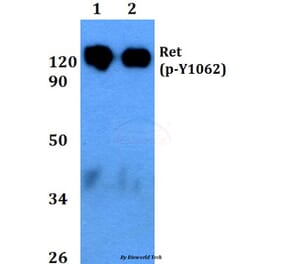 Anti-Ret (phospho-Y1062) Antibody from Bioworld Technology (BS4757) - Antibodies.com
