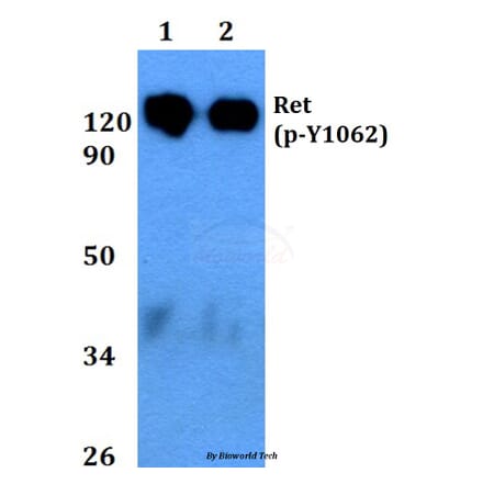 Anti-Ret (phospho-Y1062) Antibody from Bioworld Technology (BS4757) - Antibodies.com