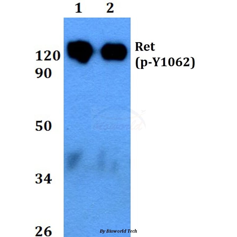 Anti-Ret (phospho-Y1062) Antibody from Bioworld Technology (BS4757) - Antibodies.com