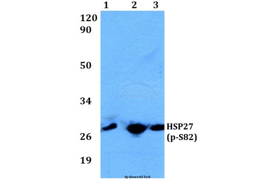 Anti-HSP27 (phospho-S82) Antibody from Bioworld Technology (BS4762) - Antibodies.com