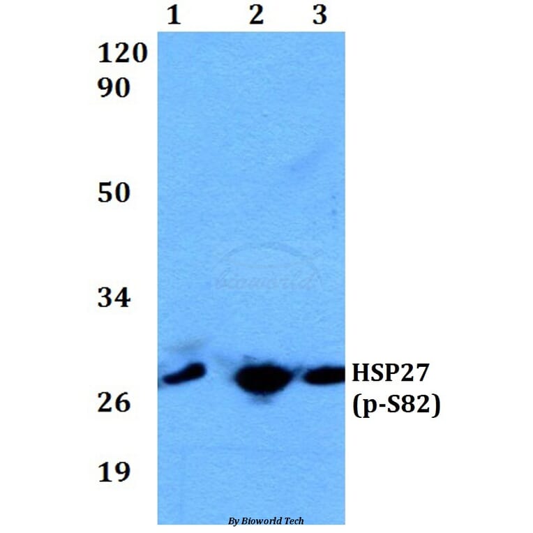 Anti-HSP27 (phospho-S82) Antibody from Bioworld Technology (BS4762) - Antibodies.com
