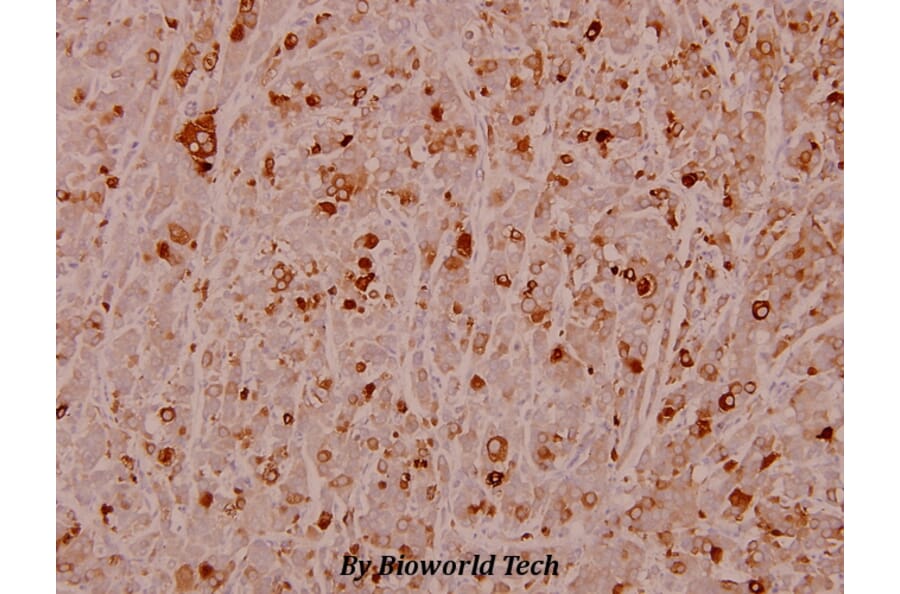 Anti-HSP27 (phospho-S82) Antibody from Bioworld Technology (BS4762) - Antibodies.com