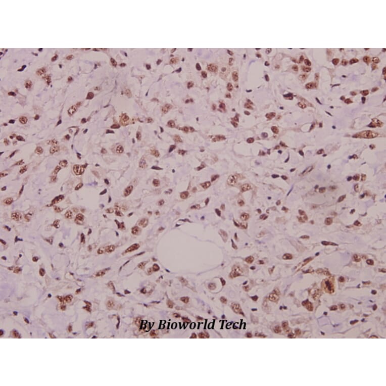 Anti-JNK1/2/3 (phospho-T183) Antibody from Bioworld Technology (BS4763) - Antibodies.com