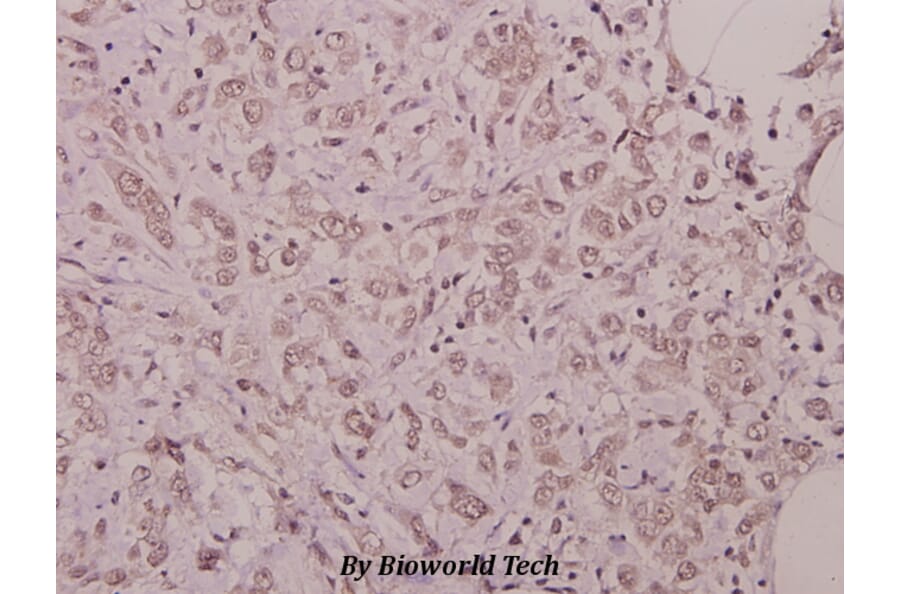Anti-p38 (phospho-Y182) Antibody from Bioworld Technology (BS4766) - Antibodies.com