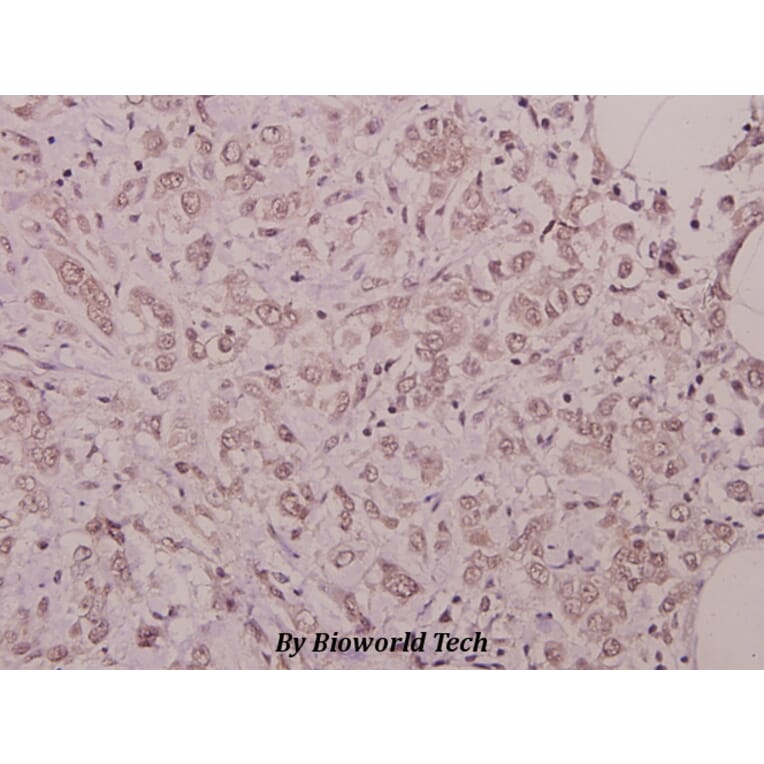 Anti-p38 (phospho-Y182) Antibody from Bioworld Technology (BS4766) - Antibodies.com