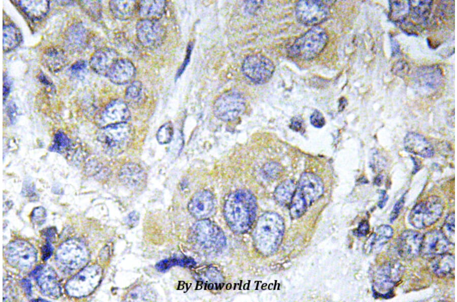 Anti-p70 S6K (phospho-S411) Antibody from Bioworld Technology (BS4767) - Antibodies.com