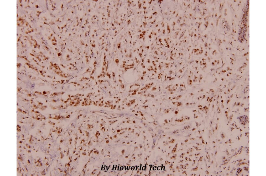 Anti-p70 S6K (phospho-S424) Antibody from Bioworld Technology (BS4769) - Antibodies.com