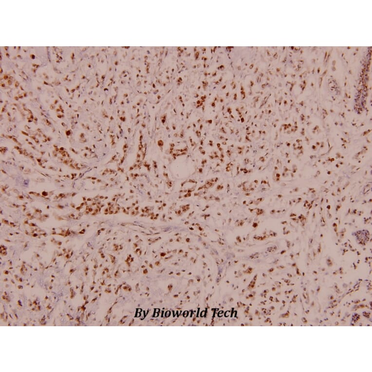 Anti-p70 S6K (phospho-S424) Antibody from Bioworld Technology (BS4769) - Antibodies.com