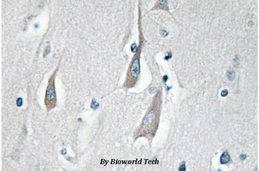 Anti-CaMKIIα/δ (phospho-T286) Antibody from Bioworld Technology (BS4773) - Antibodies.com