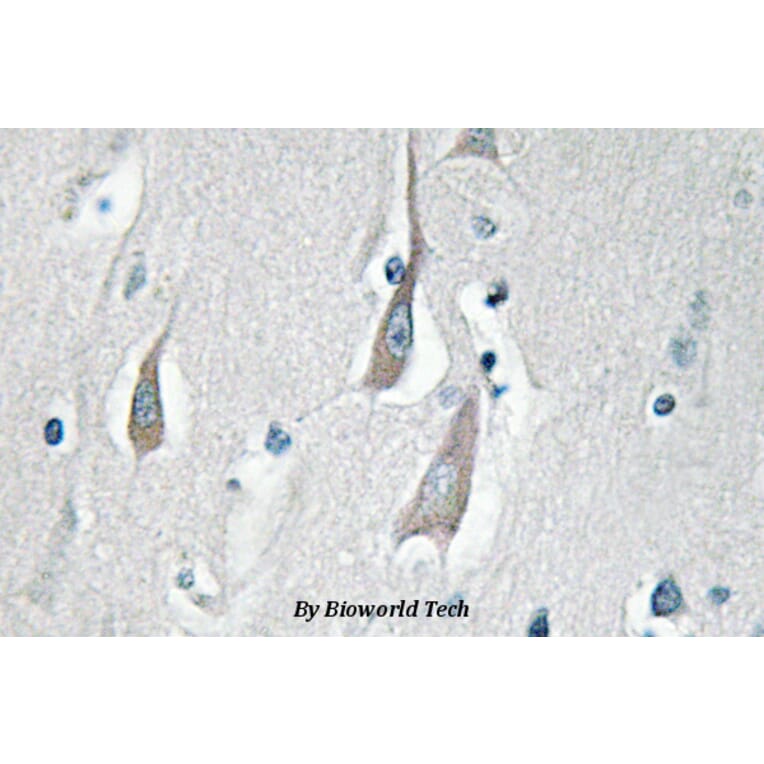Anti-CaMKIIα/δ (phospho-T286) Antibody from Bioworld Technology (BS4773) - Antibodies.com