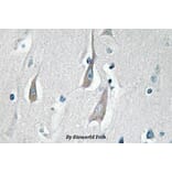 Anti-CaMKIIα/δ (phospho-T286) Antibody from Bioworld Technology (BS4773) - Antibodies.com