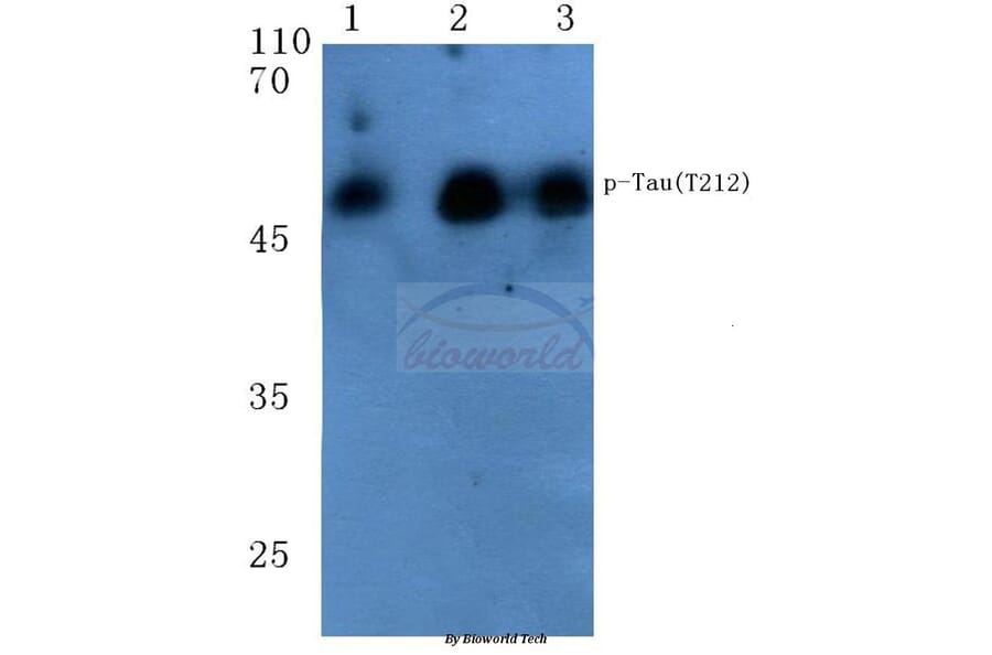 Anti-Tau (phospho-T212) Antibody from Bioworld Technology (BS4775) - Antibodies.com