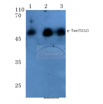Anti-Tau (phospho-T212) Antibody from Bioworld Technology (BS4775) - Antibodies.com