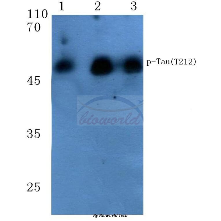 Anti-Tau (phospho-T212) Antibody from Bioworld Technology (BS4775) - Antibodies.com