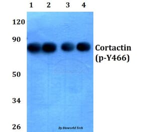 Anti-Cortactin (phospho-Y466) Antibody from Bioworld Technology (BS4779) - Antibodies.com
