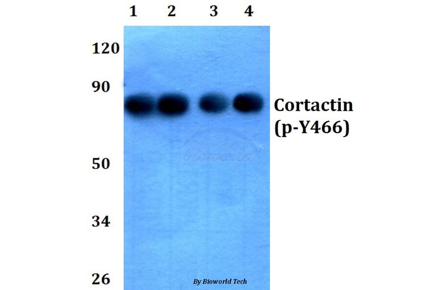 Anti-Cortactin (phospho-Y466) Antibody from Bioworld Technology (BS4779) - Antibodies.com