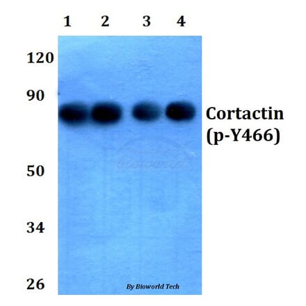 Anti-Cortactin (phospho-Y466) Antibody from Bioworld Technology (BS4779) - Antibodies.com