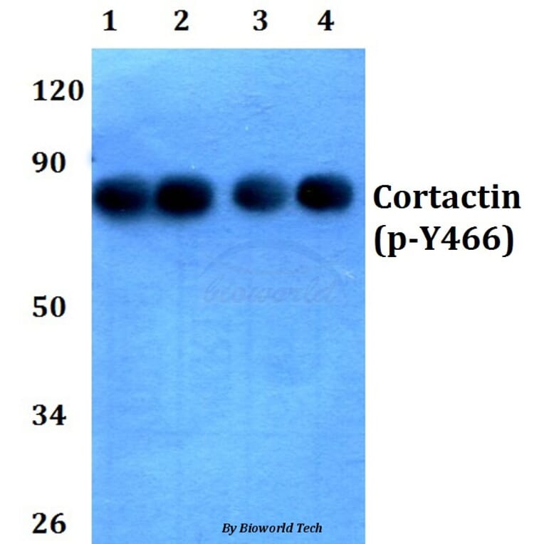 Anti-Cortactin (phospho-Y466) Antibody from Bioworld Technology (BS4779) - Antibodies.com