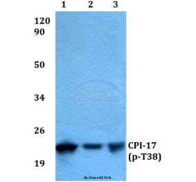 Anti-CPI-17 (phospho-T38) Antibody from Bioworld Technology (BS4780) - Antibodies.com
