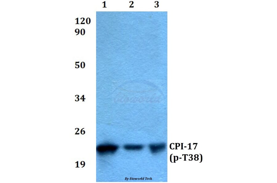Anti-CPI-17 (phospho-T38) Antibody from Bioworld Technology (BS4780) - Antibodies.com