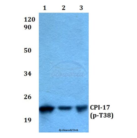 Anti-CPI-17 (phospho-T38) Antibody from Bioworld Technology (BS4780) - Antibodies.com