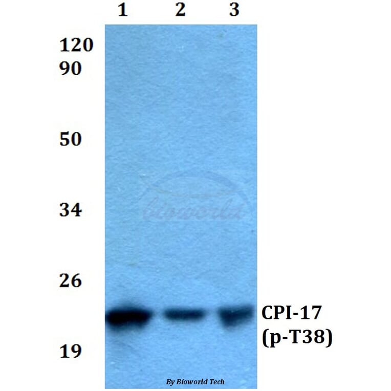 Anti-CPI-17 (phospho-T38) Antibody from Bioworld Technology (BS4780) - Antibodies.com