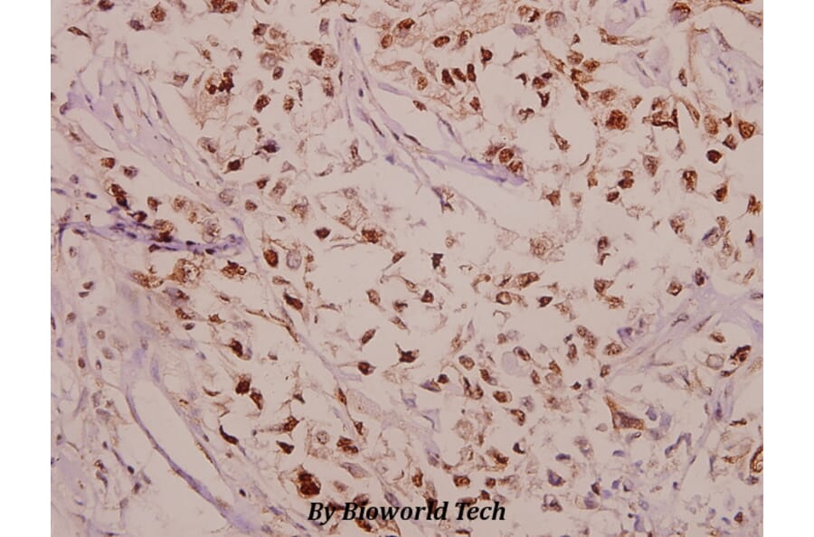 Anti-CPI-17 (phospho-T38) Antibody from Bioworld Technology (BS4780) - Antibodies.com