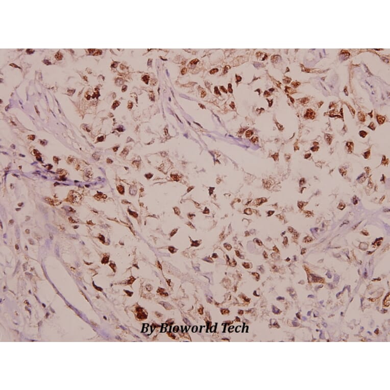 Anti-CPI-17 (phospho-T38) Antibody from Bioworld Technology (BS4780) - Antibodies.com