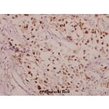 Anti-CPI-17 (phospho-T38) Antibody from Bioworld Technology (BS4780) - Antibodies.com