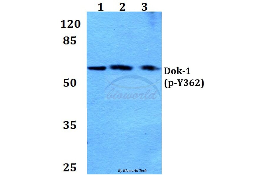 Anti-Dok-1 (phospho-Y362) Antibody from Bioworld Technology (BS4784) - Antibodies.com