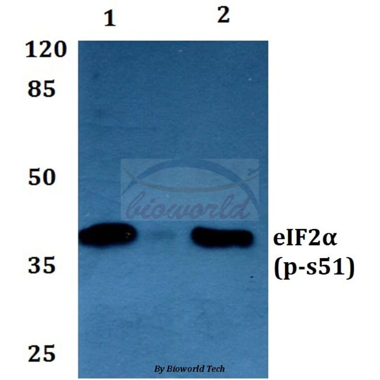 Anti-eIF2α (phospho-S51) Antibody from Bioworld Technology (BS4787) - Antibodies.com