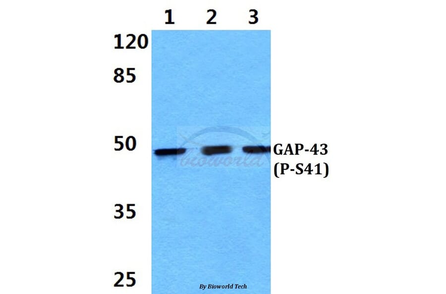 Anti-GAP43 (phospho-S41) Antibody from Bioworld Technology (BS4791) - Antibodies.com