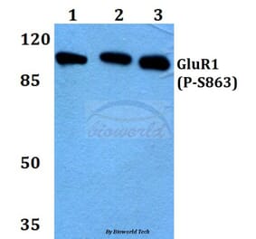 Anti-GluR1 (phospho-S863) Antibody from Bioworld Technology (BS4793) - Antibodies.com