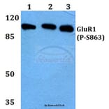 Anti-GluR1 (phospho-S863) Antibody from Bioworld Technology (BS4793) - Antibodies.com