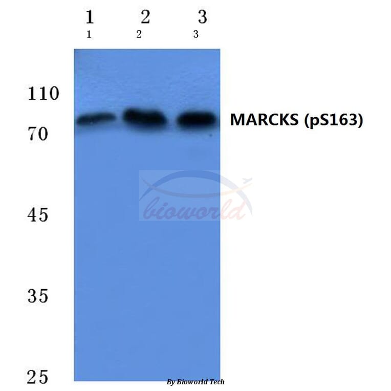 Anti-MARCKS (phospho-S163) Antibody from Bioworld Technology (BS4799) - Antibodies.com